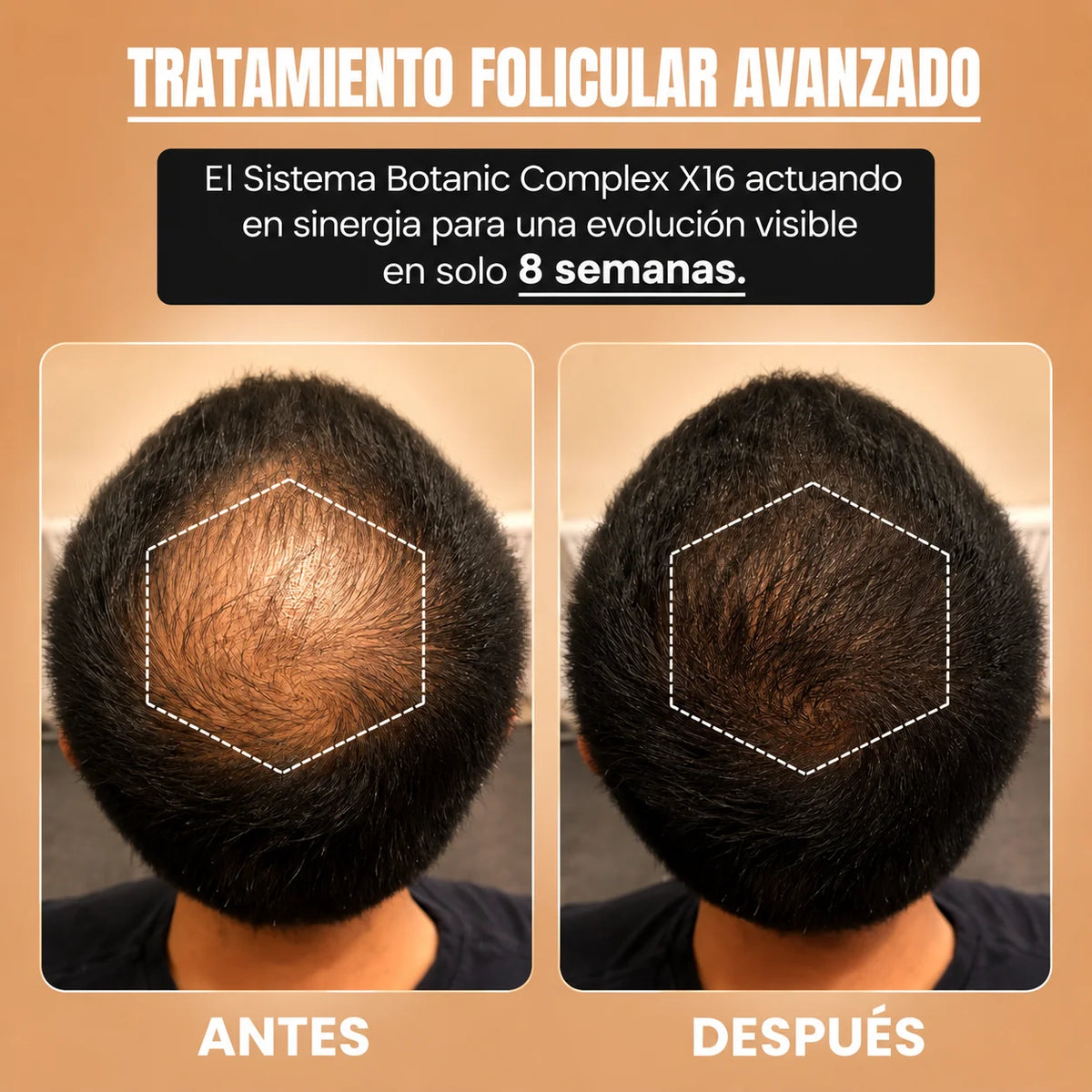 Revitaly™ – Recuperá un cabello más fuerte y abundante