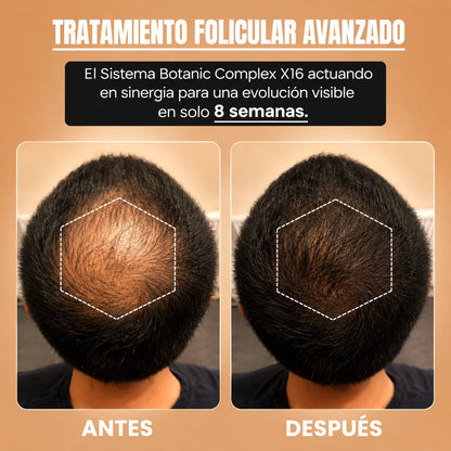Revitaly™ – Recuperá un cabello más fuerte y abundante